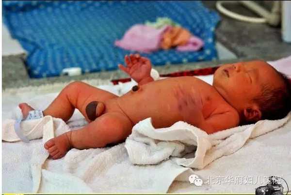 广州供卵在哪_南京一女子遇交通事故10天后“试管婴儿流产”法院是这样判决的