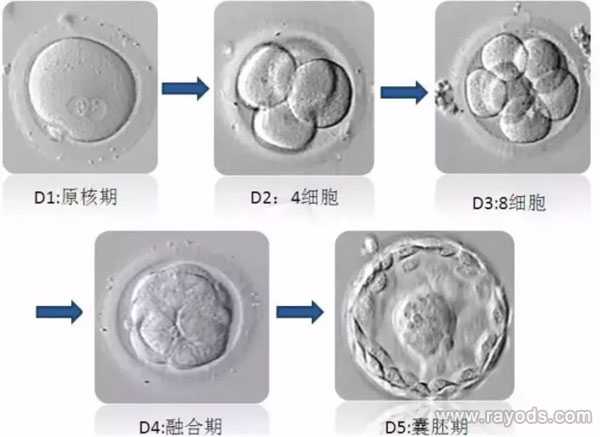 代怀孕哪家专业_最新代怀价格表,试管胚胎等级分类，二级胚胎是不是优质胚胎